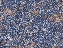 SQSTM1 Antibody (clone OTI1E9, Carrier-free)
