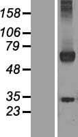 WDR20 Protein (Over-Expression Lysate Myc-DDK (Flag))