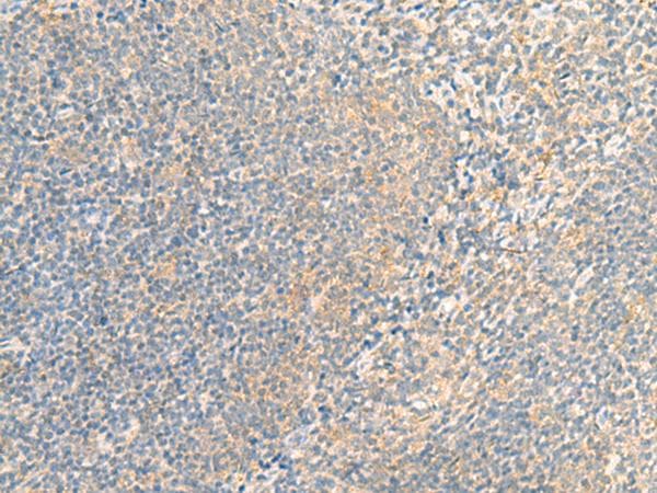 IFNA5 / Interferon Alpha 5 Antibody