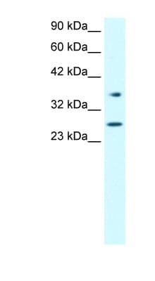 FOXA3 Antibody (aa201-250)