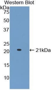 ADAMTS2 Antibody (aa855-1030)