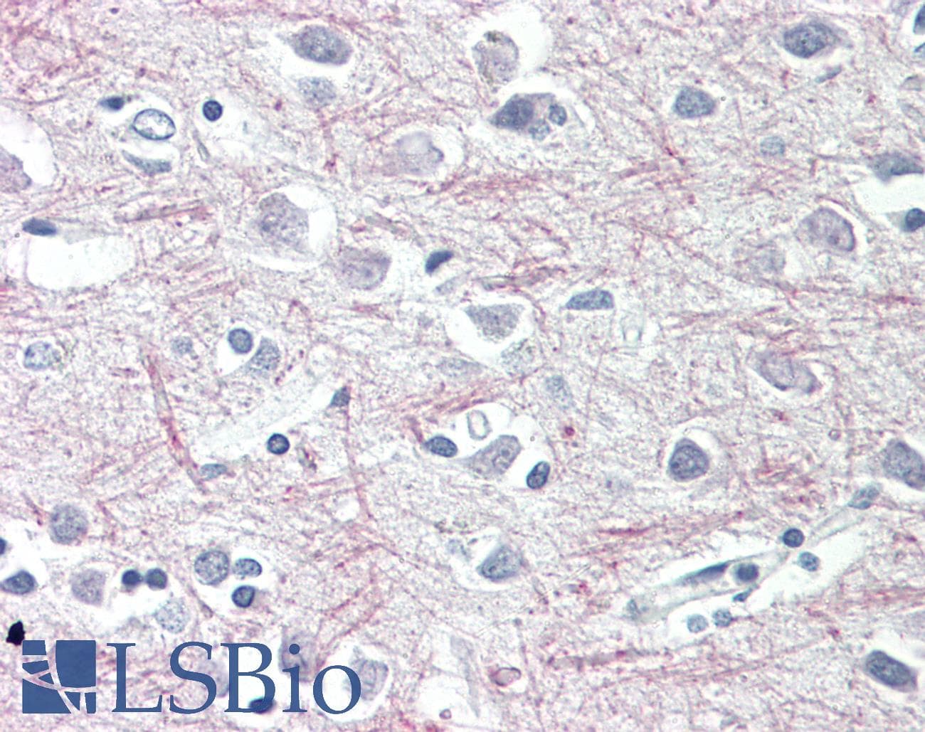 IHC-plus™ Polyclonal Rabbit anti-Human TAOK1 / TAO1 Antibody (aa431-480, IHC, WB)