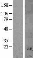 MT1H Protein (Over-Expression Lysate Myc-DDK (Flag))