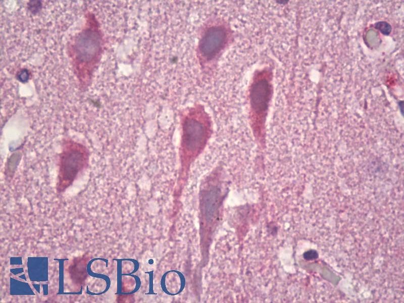 IHC-plus™ Polyclonal Rabbit anti-Human GRM8 / MGLUR8 Antibody (aa841-890, IHC, WB)