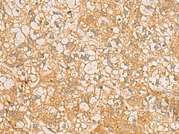 Polyclonal Rabbit anti-Human C17orf70 Antibody (IHC)