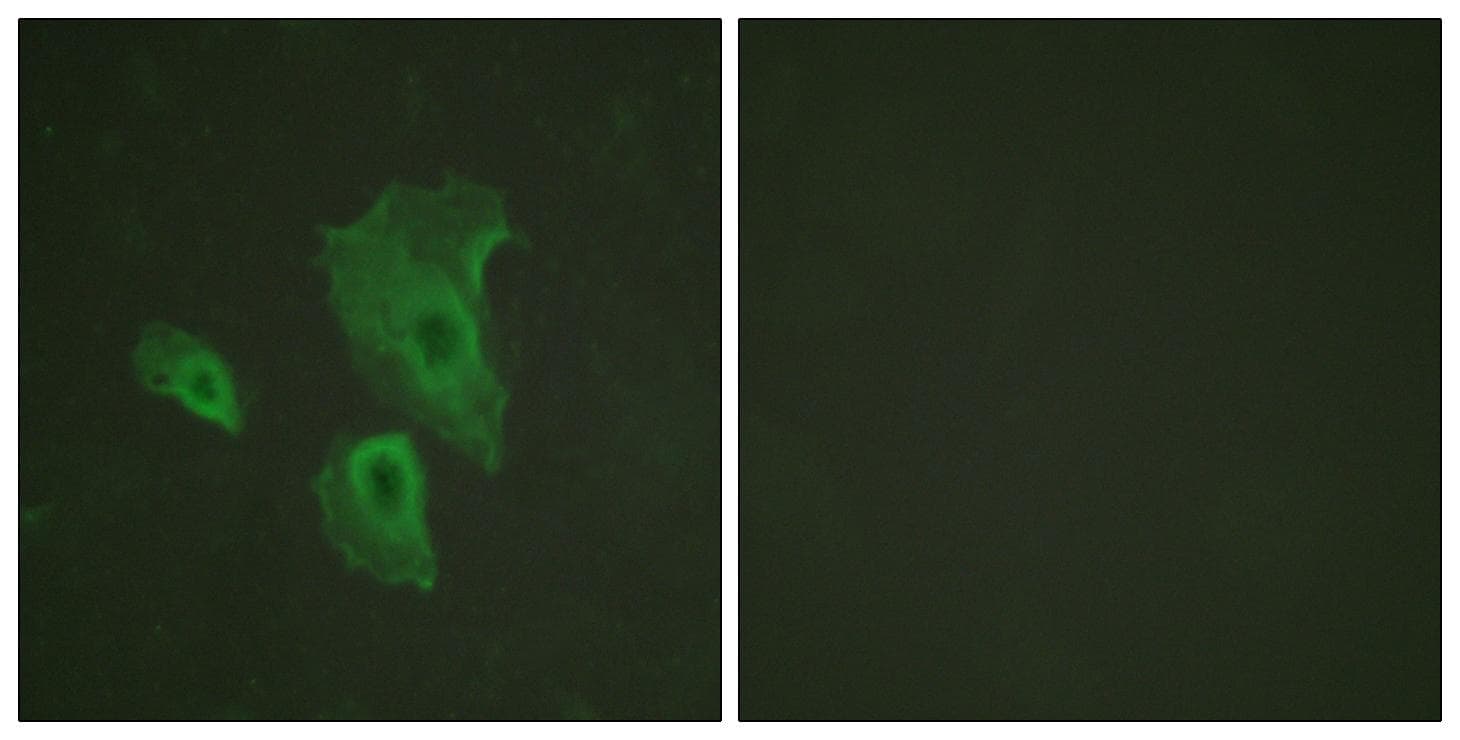 Polyclonal Rabbit anti-Human BCL2 / Bcl-2 Antibody (phospho-Thr69, IHC, IF)