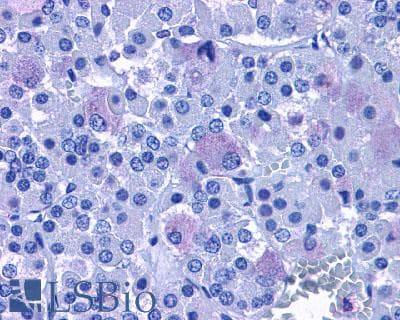 IHC-plus™ ADCYAP1R1 / PAC1 Receptor Antibody (C-Terminus)