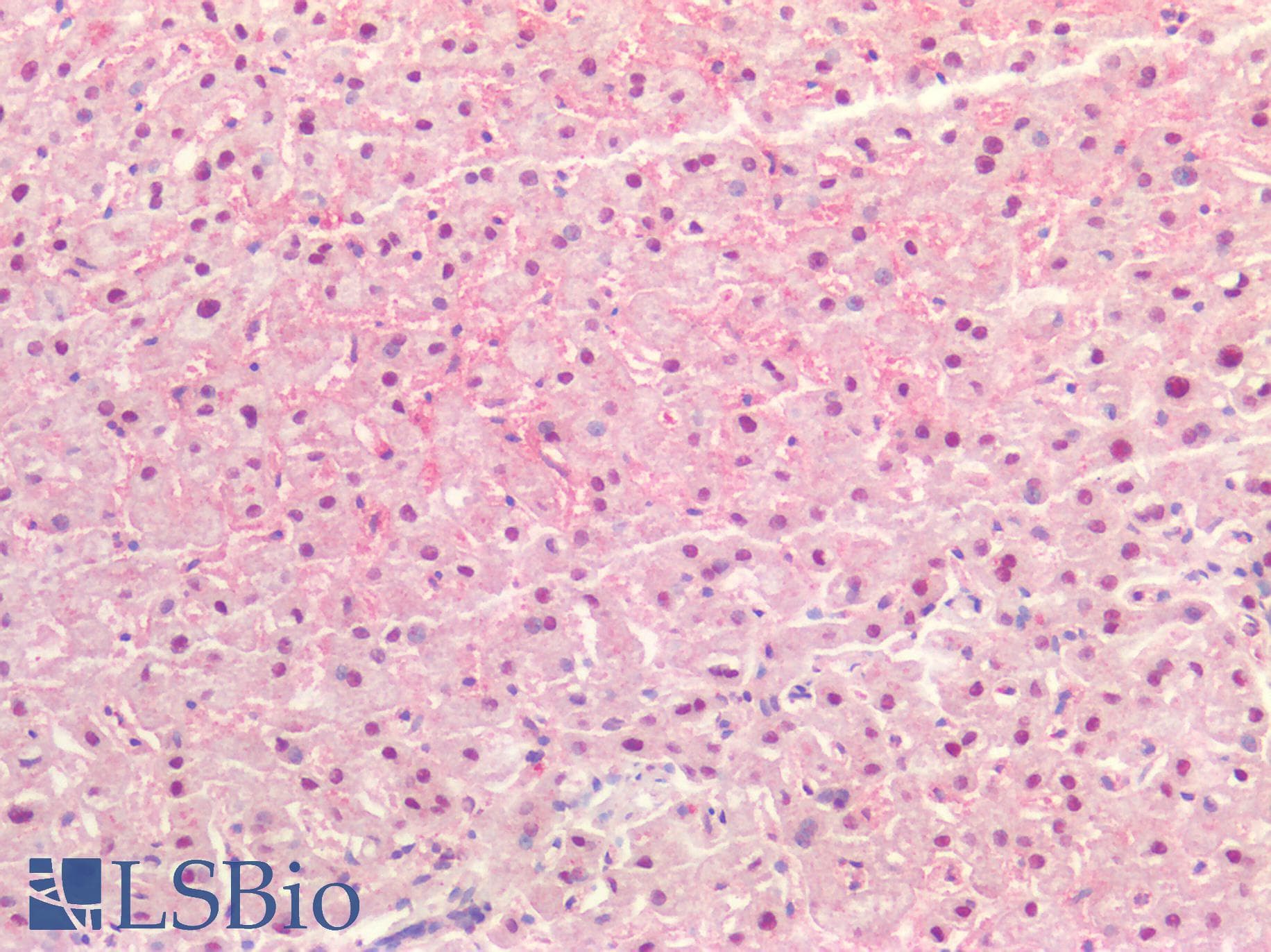 PathPlus™ Polyclonal Rabbit anti-Human TTR / Transthyretin Antibody (IHC)