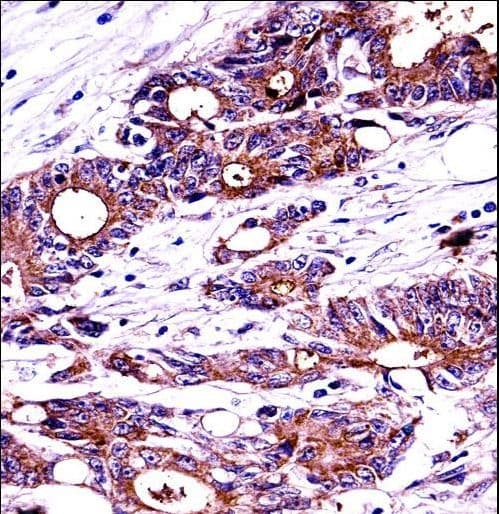 NPM1 / NPM / Nucleophosmin Antibody (aa198-226)