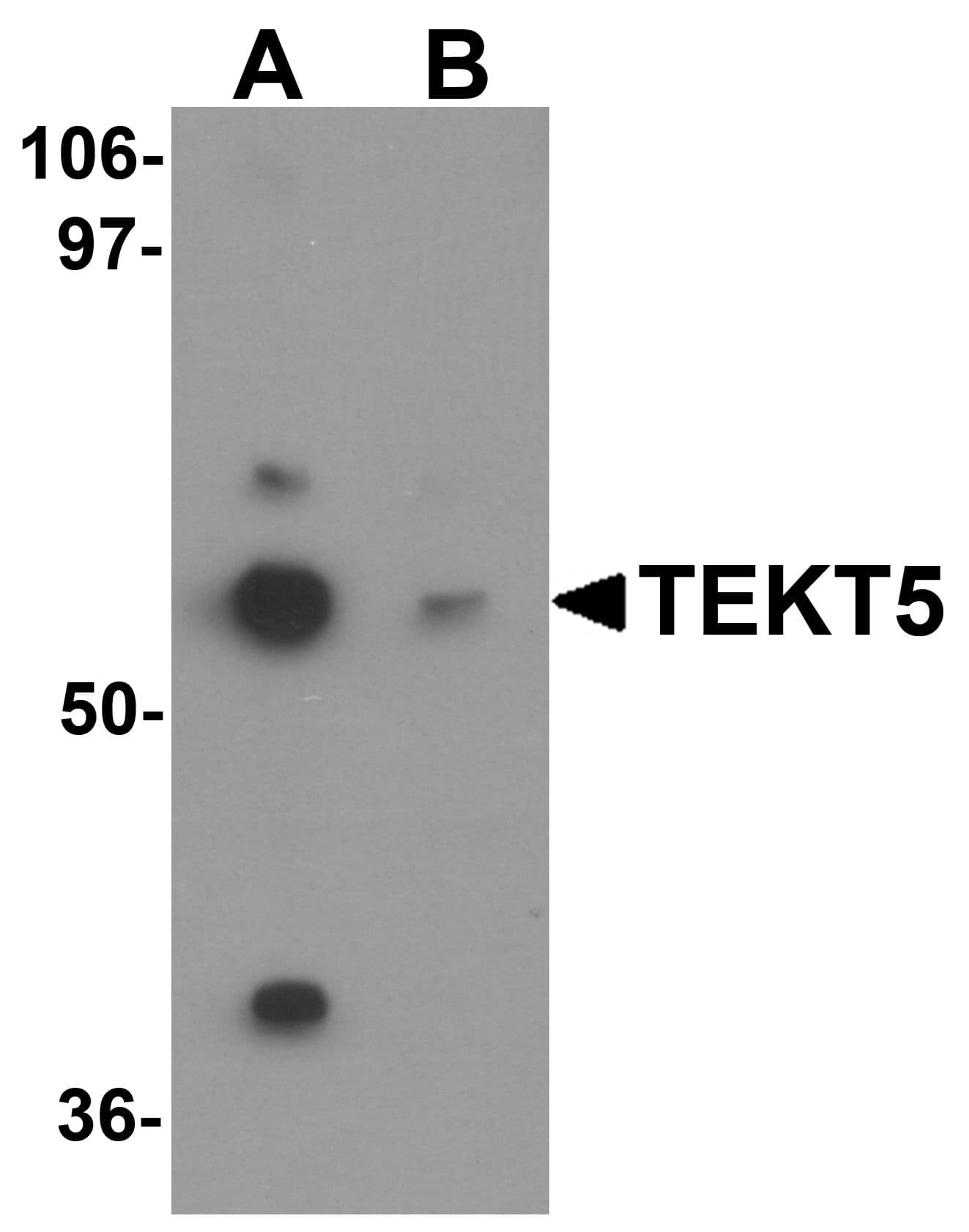 IHC-plus™ Polyclonal Rabbit anti-Human TEKT5 Antibody (IHC, WB)