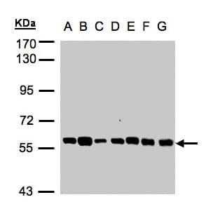 Polyclonal Rabbit anti-Human TULP1 Antibody (aa281-542, IHC, WB)