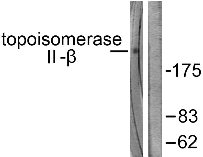 Polyclonal Rabbit anti-Human TOP2B / Topoisomerase II Beta Antibody (aa1-50, IHC, WB)