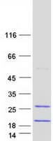 Human FAM103A1 Protein (Recombinant Myc-DDK (Flag))