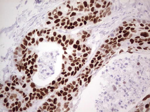 TP53 / p53 Antibody (clone OTI5B1)