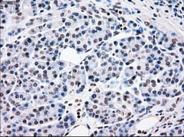 BRAF / B-Raf Antibody (clone OTI3A7)