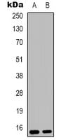 Polyclonal Rabbit anti-Human RPS12 / Ribosomal Protein S12 Antibody (C-Terminus, IHC, IF, WB)