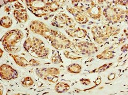 ACSM3 / SAH Antibody (aa387-586)