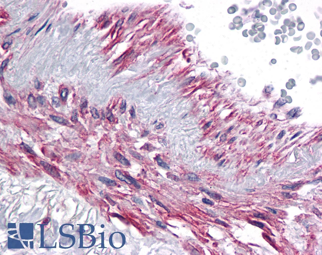 IHC-plus™ Polyclonal Rabbit anti-Human ARL15 Antibody (IHC, WB)