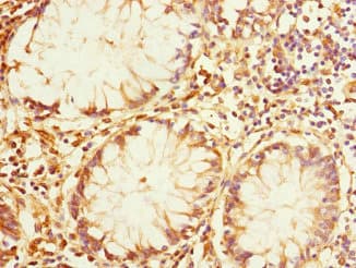 Polyclonal Rabbit anti-Human IQGAP3 Antibody (IHC)