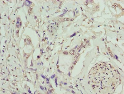 Polyclonal Rabbit anti-Human TMEM53 Antibody (IHC, WB)