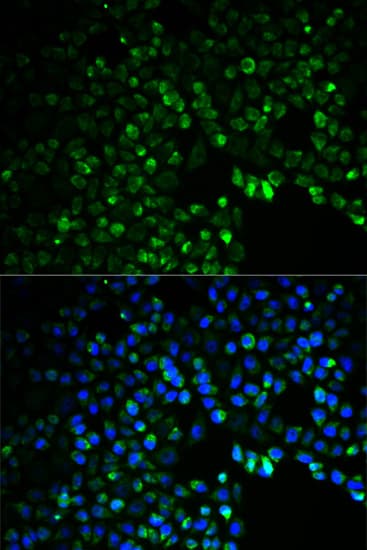 Polyclonal Rabbit anti-Human UGDH / UDPGDH Antibody (IHC, IF, WB)