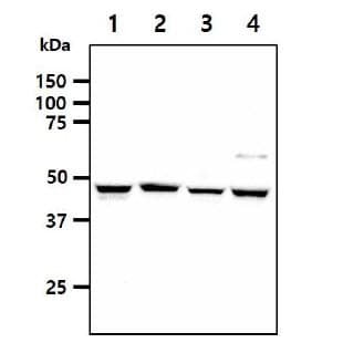 IHC-plus™ SHMT / SHMT1 Antibody (clone AT26E5)