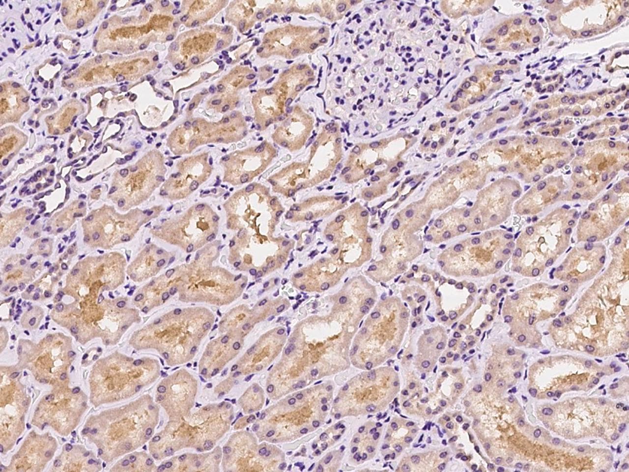 Polyclonal Rabbit anti-Human ARHGDIA / RHOGDI Antibody (IHC, WB)