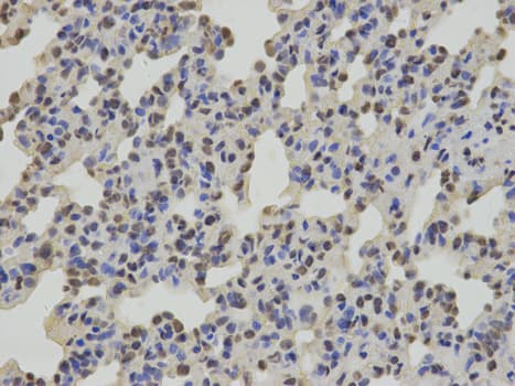 SUMO2 Antibody