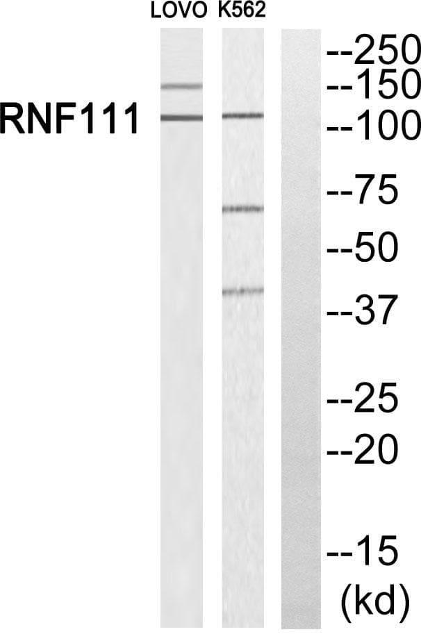 Polyclonal Rabbit anti-Human Arkadia / RNF111 Antibody (WB)