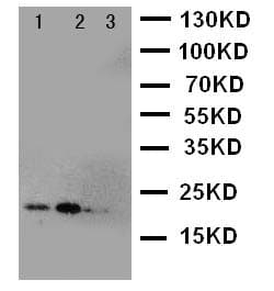 Polyclonal Rabbit anti-Human FGF21 Antibody (aa43-58, WB)
