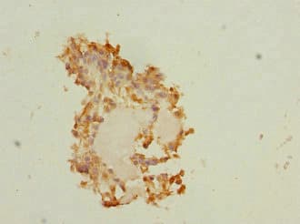 Polyclonal Rabbit anti-Human PEG1 / MEST Antibody (IHC)