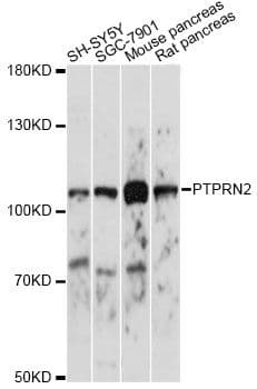 Polyclonal Rabbit anti-Human PTPRN2 / Phogrin Antibody (WB)