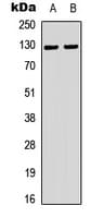 TERT / Telomerase Antibody (phospho-Ser824)