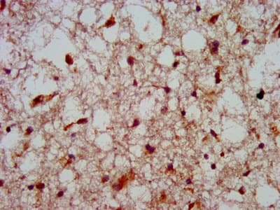 Polyclonal Rabbit anti-Human HOXA4 Antibody (IHC, WB)