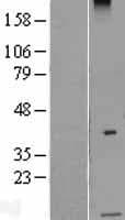 Human Sma3 Protein (Over-Expression Lysate Myc-DDK (Flag))