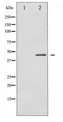 RPS6KB2 / S6K2 Antibody