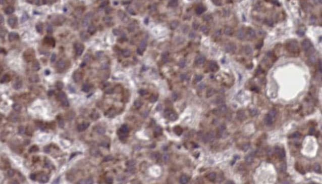 LPAR5 / GPR92 Antibody