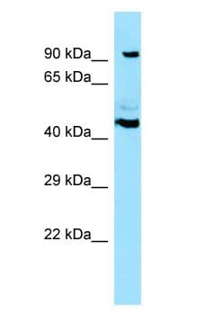 Polyclonal Rabbit anti-Human SPECC1 / CYTSB Antibody (aa148-197, WB)