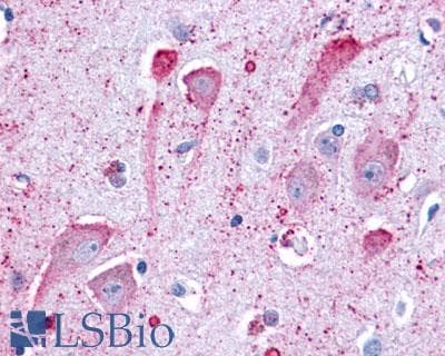 PathPlus™ GPR34 Antibody (C-Terminus)