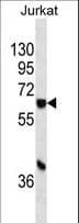 Monoclonal Mouse anti-Human CYP1A1 Antibody (aa377-405, WB)