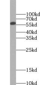FTO Antibody