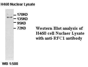RFC1 / RFC Antibody