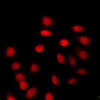 Histone H4 Antibody (Acetyl-Lys12)