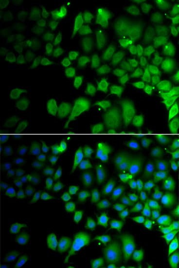 Polyclonal Rabbit anti-Human JMJD7 Antibody (IHC, IF, WB)