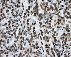 ARNT / HIF-1-Beta Antibody (clone OTI1A1)