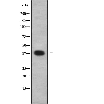 Polyclonal Rabbit anti-Human ISG20L2 Antibody (WB)