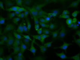 ACAT2 Antibody (clone OTI5A2)