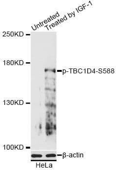 TBC1D4 / AS160 Antibody (phospho-Ser588)