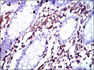 Monoclonal Mouse anti-Human MSN / Moesin Antibody (clone 2C12, IHC, WB)