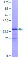 Human NPHP4 Protein (Recombinant GST)
